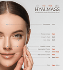 HYALMASS SOFT – 1 × 1 mL